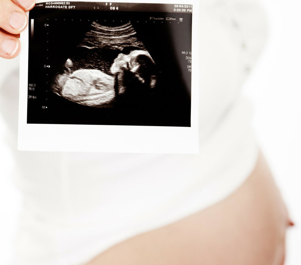 Pregnant woman holds out ultrasound photo