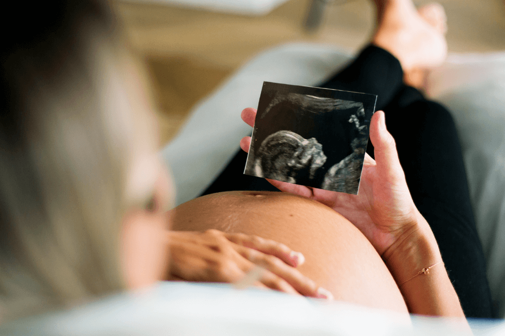Pregnant mom looks at ultrasound image